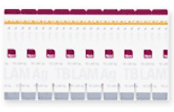 Image: The Alere Determine TB LAM Ag test for diagnostic screening of HIV-associated TB (Photo courtesy of Alere).